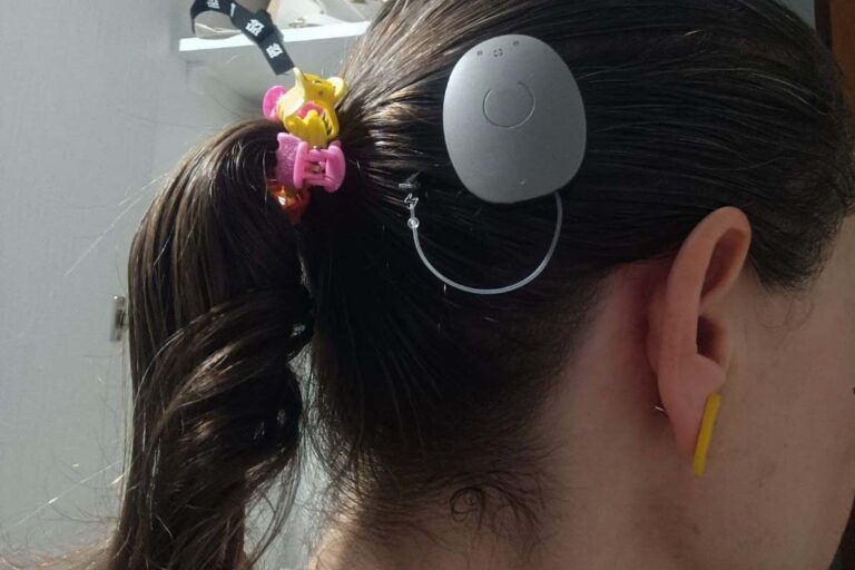 Como fazer implante auditivo gratuito no Paraná pelo SUS? Veja o passo a passo